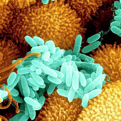 Pseudomonas aeruginosa bacteria .